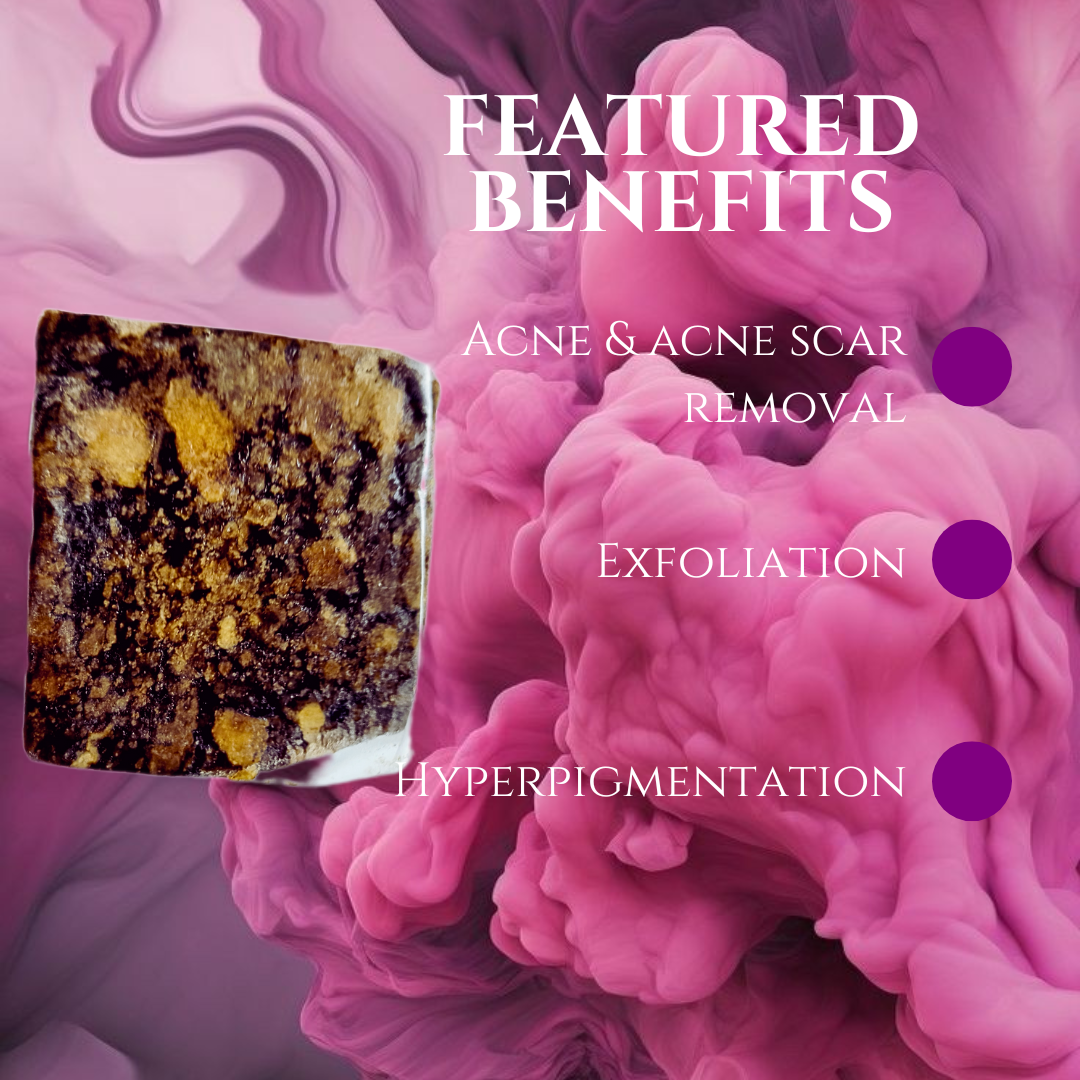 African black soap-hyperpigmentation-acne- african black soap black soap benefits